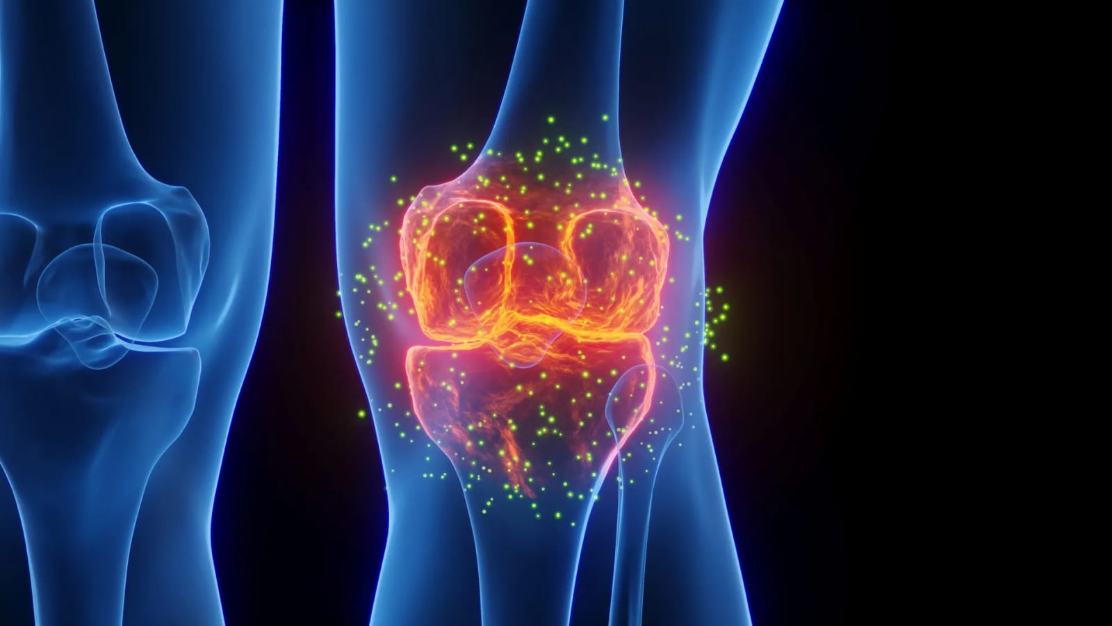 Ultra-processed foods linked to hidden muscle fat that may threaten your knees